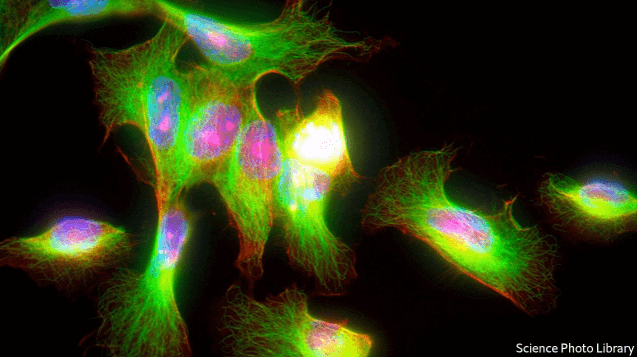 Growing tiny tumours in the lab could help treat cancer