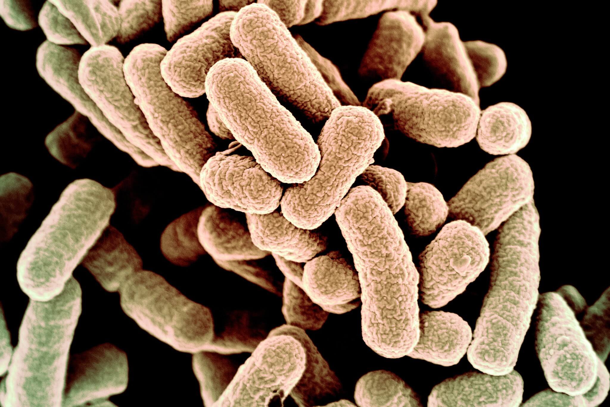 Scientists Created Bacteria With a Synthetic Genome. Is This Artificial Life?