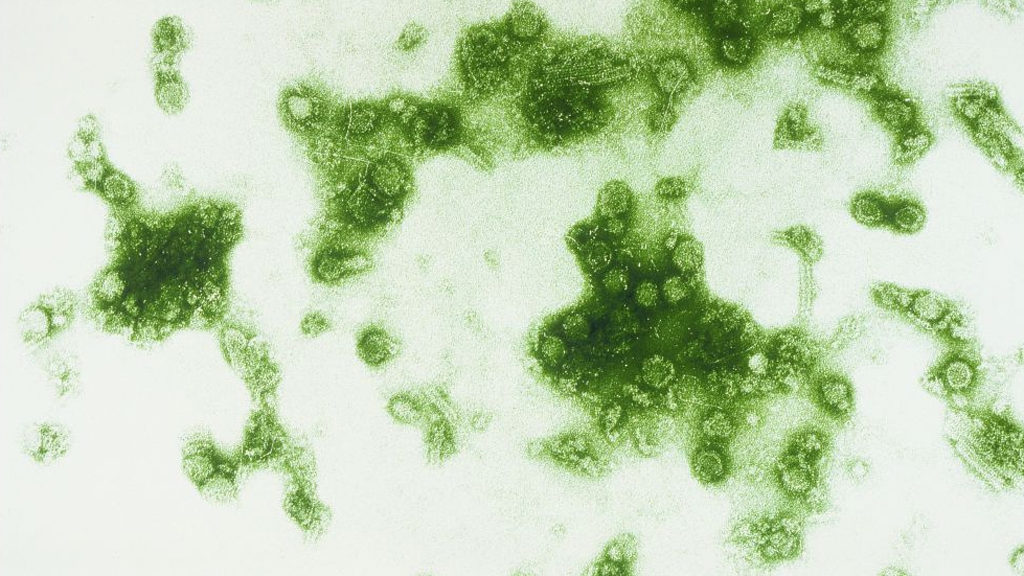 Scientists solve a dengue mystery: Why second infection is worse than first